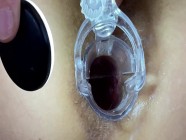 Japanese schoolgirl with a dilator in the ass. From the ass to the mouth. | PORR.XXX